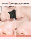 Remover Nose Pore